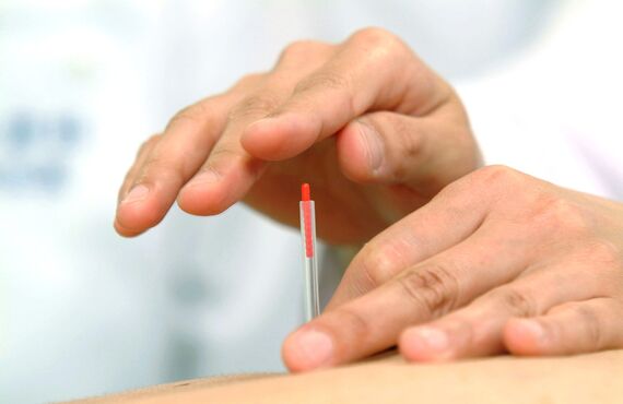 熊本にある当院ではスポーツによる捻挫への鍼灸を行っております