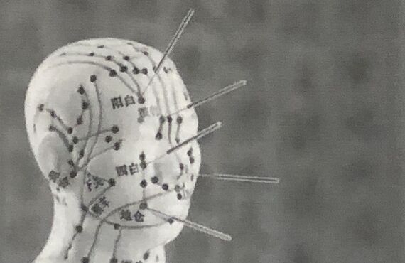 顔面神経麻痺でお困りの50代の方は天草にあるくわはら鍼灸院へお任せください